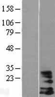 HCST Human Over-expression Lysate