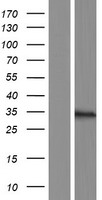 KLHDC9 Human Over-expression Lysate