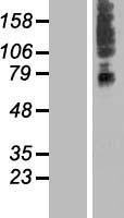 SLC41A3 Human Over-expression Lysate