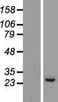GPX8 Human Over-expression Lysate