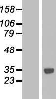 CTDSPL Human Over-expression Lysate