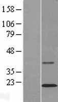 TMCO2 Human Over-expression Lysate