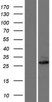 MTX3 Human Over-expression Lysate