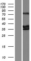 PAP2D (PLPPR5) Human Over-expression Lysate