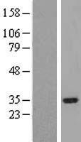 IRAK1BP1 Human Over-expression Lysate