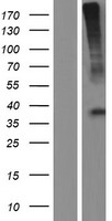 GHRHR Human Over-expression Lysate