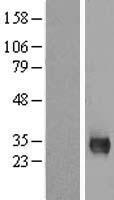 MPG Human Over-expression Lysate