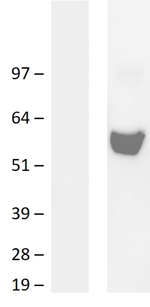 ME3 Human Over-expression Lysate