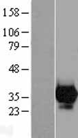 CA7 Human Over-expression Lysate