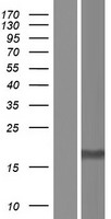 Ribosomal protein S10 (RPS10) Human Over-expression Lysate