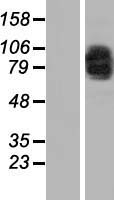 MAD1 (MAD1L1) Human Over-expression Lysate