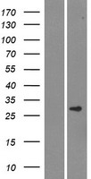 C12orf69 (SMCO3) Human Over-expression Lysate