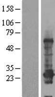 C12orf68 (CCDC184) Human Over-expression Lysate