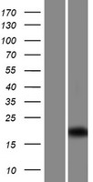 C1orf192 (CFAP126) Human Over-expression Lysate