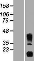 IL32 Human Over-expression Lysate