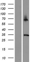 ASB11 Human Over-expression Lysate