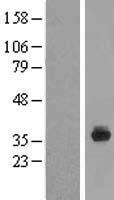 SPIN4 Human Over-expression Lysate