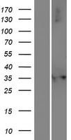 NUDT17 Human Over-expression Lysate