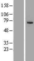 SLC27A6 Human Over-expression Lysate
