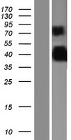 Protor 1 (PRR5) Human Over-expression Lysate