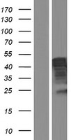 SERBP1 Human Over-expression Lysate