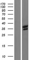 BRCC36 (BRCC3) Human Over-expression Lysate