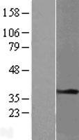 TPM1 Human Over-expression Lysate