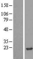 NME2 Human Over-expression Lysate