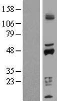 Cytochrome P450 2D6 (CYP2D6) Human Over-expression Lysate