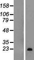 Myelin Basic Protein (MBP) Human Over-expression Lysate