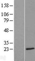 Myelin Basic Protein (MBP) Human Over-expression Lysate