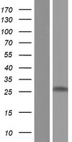 Myelin Basic Protein (MBP) Human Over-expression Lysate