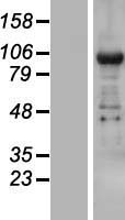TNRC6B Human Over-expression Lysate