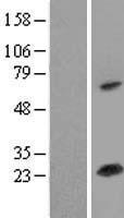 SOD2 Human Over-expression Lysate