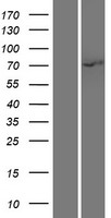 IRAK (IRAK1) Human Over-expression Lysate