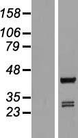 ARFIP1 Human Over-expression Lysate