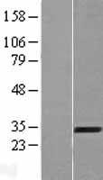 AMMECR1 Human Over-expression Lysate