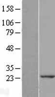 SAR1B Human Over-expression Lysate