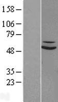 SUOX Human Over-expression Lysate