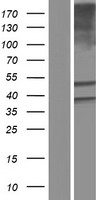 ALDH3B1 Human Over-expression Lysate