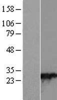 RAB28 Human Over-expression Lysate