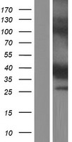 CYB5RL Human Over-expression Lysate
