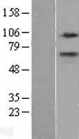 CPT1A Human Over-expression Lysate