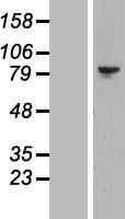 LIM kinase 2 (LIMK2) Human Over-expression Lysate