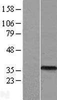 ASB9 Human Over-expression Lysate
