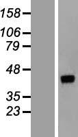 DNAJB14 Human Over-expression Lysate