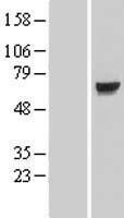 KLHL7 Human Over-expression Lysate