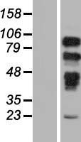 PRPF40B Human Over-expression Lysate