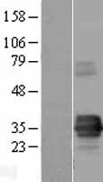 TIRAP Human Over-expression Lysate