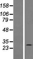 INSYN1 Human Over-expression Lysate